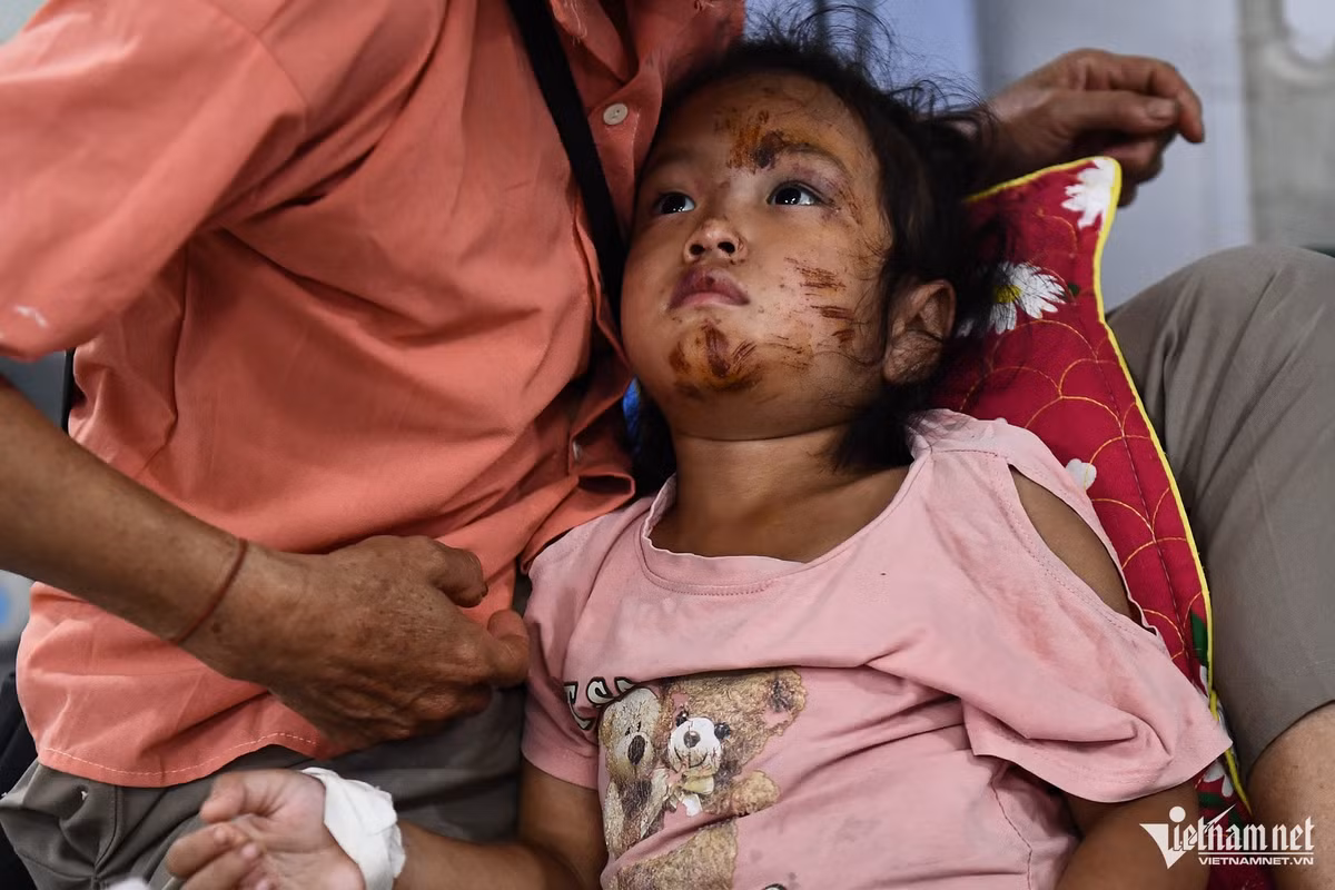 23h30 khuya 11/9, bé Hoàng Ngọc Lan (6 tuổi) vẫn thức vì kêu đau ở lưng và chân. Trong trận lũ quét kinh hoàng, bé may mắn được một người đi thăm nước đêm gần đó cứu sống. Em sống ở thôn Làng Nủ cùng bố mẹ, hiện cả 2 đều chưa được tìm thấy. Bà ngoại nghe tin dữ, sáng hôm đó tức tốc chạy vào viện chăm cháu gái. Ngọc Lan bị hội chứng vùi lấp, phổi của em bị sặc bởi bùn đất, nhiều phần da sây sát rất nặng.