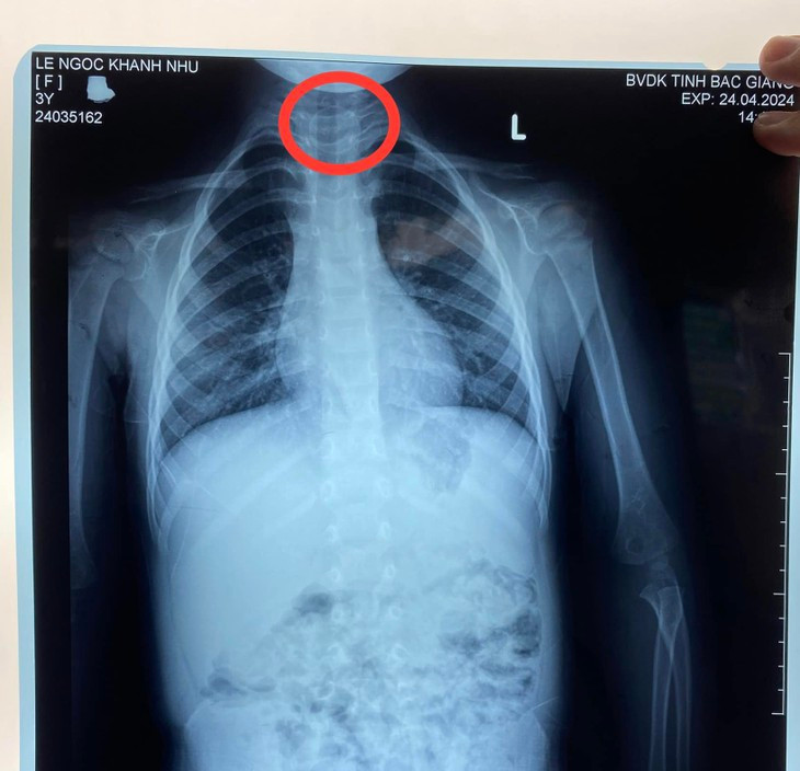 Gap dong xu may tro choi trong thuc quan be gai 3 tuoi-Hinh-2