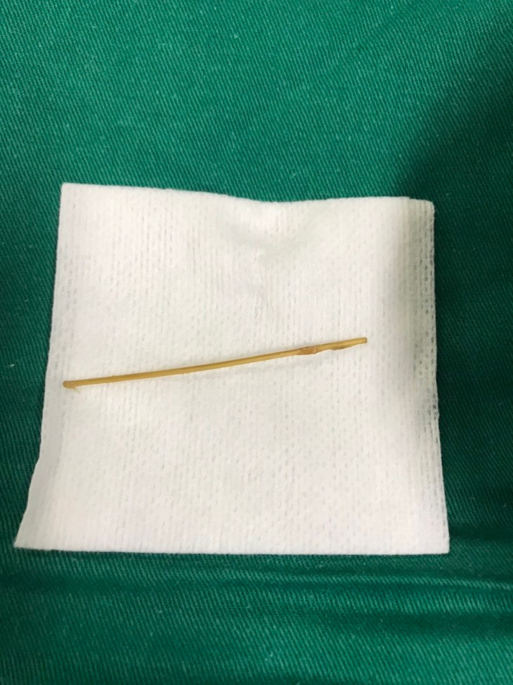 Nguoi phu nu thung ruot do thoi quen ngam tam sau khi an