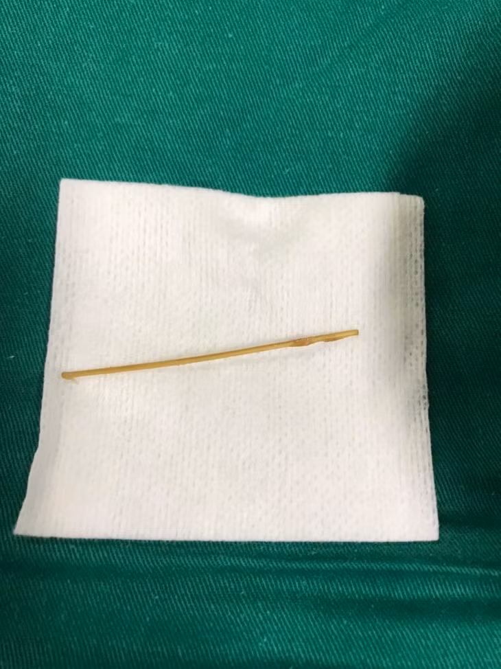 Nguoi phu nu thung ruot do thoi quen ngam tam sau khi an