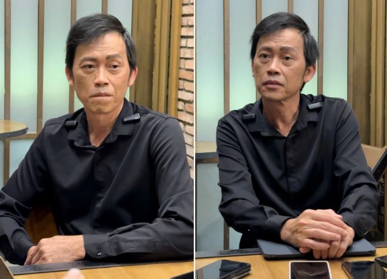 Hoai Linh mat ngu 20 nam qua, hai lan hoa tri ung thu-Hinh-2