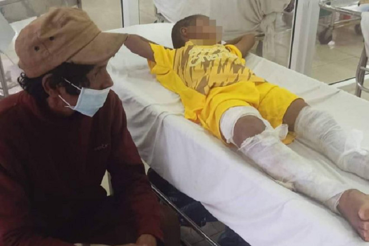 Gia canh khon kho cua be 8 tuoi o Dak Lak bi dot bong 2 chan-Hinh-2