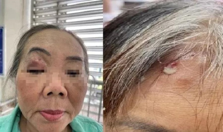 Nam den gay hoai tu xuong ham: Ai co nguy co mac?