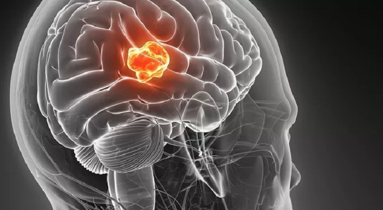 Dot pha: Dung kim dai va dien ha guc benh ung thu