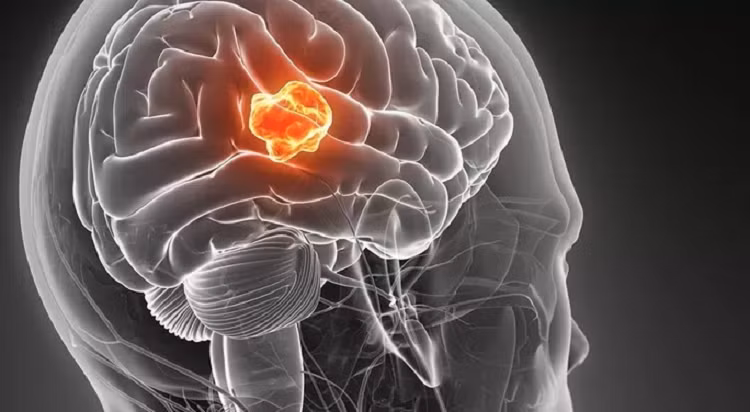 Dot pha: Dung kim dai va dien ha guc benh ung thu