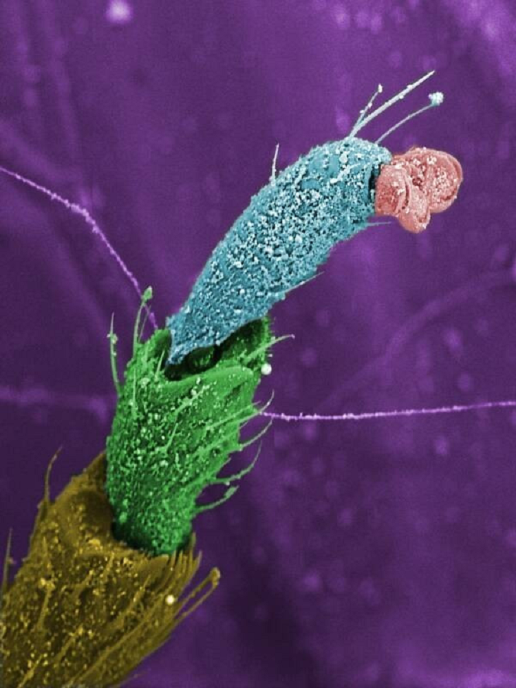 Chân của một con ruồi. 