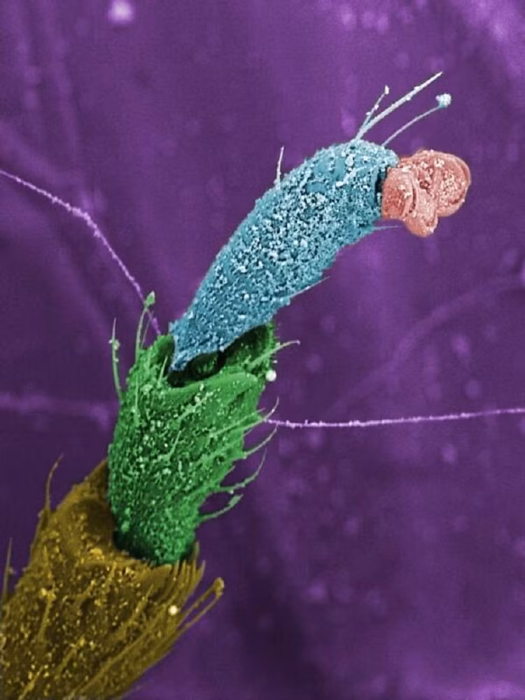 Chân của một con ruồi. 