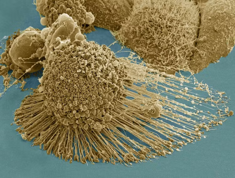 Tế bào HeLa vừa được phân chia. Đây là một loại tế bào bền vững, nguyên sinh, thu được trong quá trình điều trị bệnh ung thư Henrietta Lacks bởi Tiến sĩ George Gey, nhà nghiên cứu của Johns Hopkins vào năm 1951. 