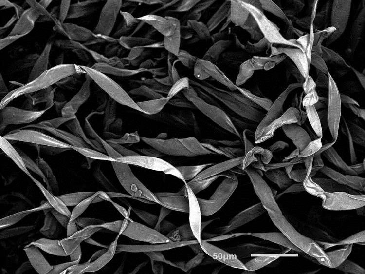 Các sợi lót bên trong vỏ quả sồi có độ phóng đại 300 lần. 