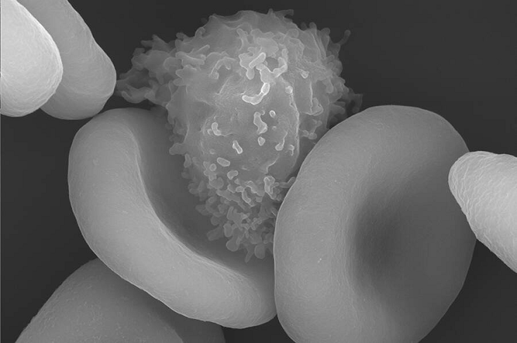 Tế bào hồng cầu của con người và một tế bào lympho. 