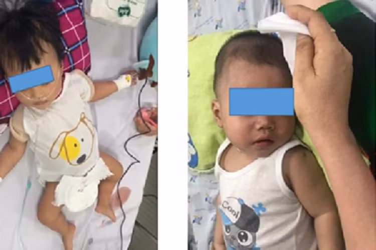 TP HCM: Hang loat tre so sinh mac sot xuat huyet nguy kich