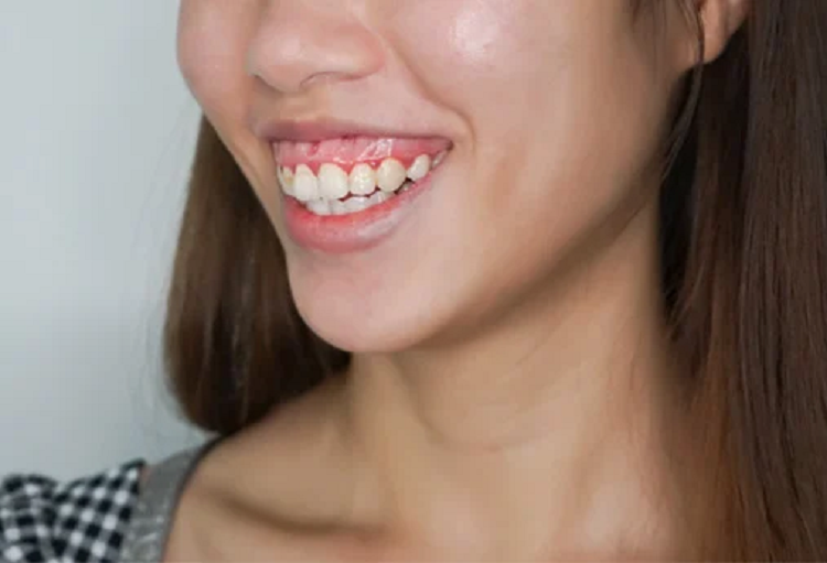 Bo 2 giay nhin mieng phu nu, biet ngay van menh giau hay ngheo-Hinh-2