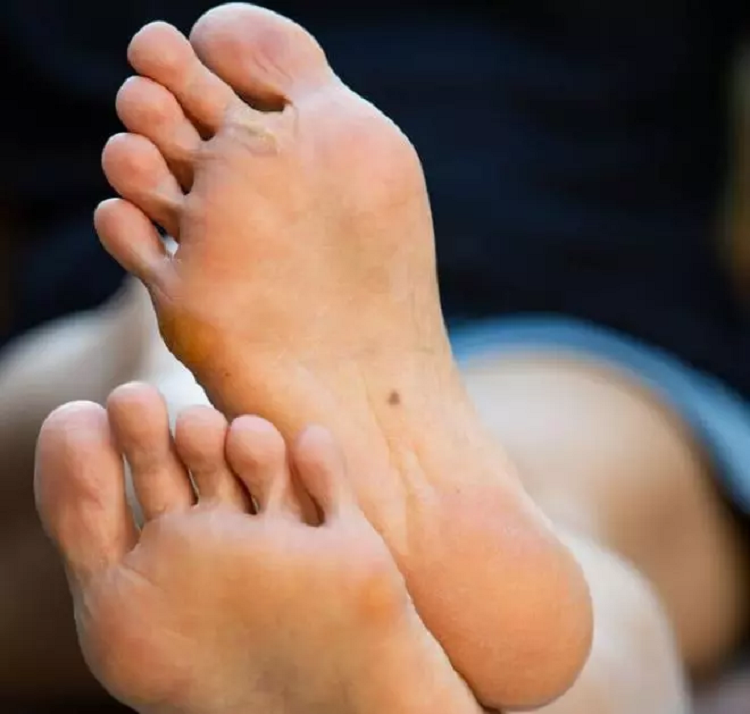 Not ruoi o 6 vi tri nay tren co the tiet lo gi ve tinh cach ban?-Hinh-4