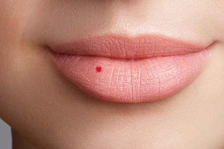 Nốt ruồi ở môi dưới. Người này có tính cách chăm chỉ, cần cù, làm bất cứ việc gì cũng tỉ mỉ cẩn thận nên được các sếp trên tín nhiệm. Ảnh: pinterest 