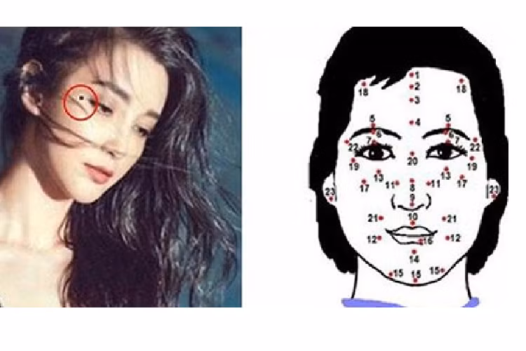 Nốt ruồi ở huyệt thái dương. Ra đường gặp quý nhân hoặc có nguồn lợi phát triển từ bên ngoài, bạn thích hợp xuất ngoại hay di cư đến nơi khác. Ảnh: pinterest 