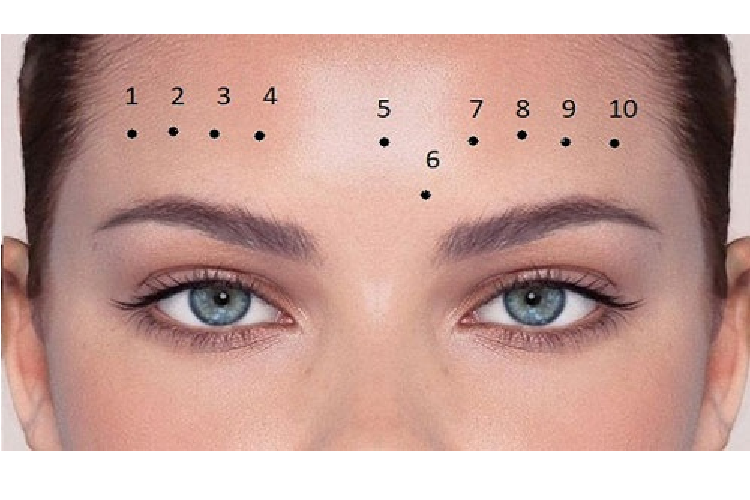 Nốt ruồi trên trán. Theo ngũ hành, trán thuộc Hỏa, mà nốt ruồi lại thuộc Thổ, Hỏa Thổ tương sinh. Ngoài ra Hỏa vượng có Thổ tiết là một hiện tượng tốt. Ảnh: pinterest 