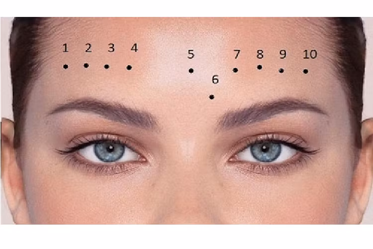 Nốt ruồi trên trán. Theo ngũ hành, trán thuộc Hỏa, mà nốt ruồi lại thuộc Thổ, Hỏa Thổ tương sinh. Ngoài ra Hỏa vượng có Thổ tiết là một hiện tượng tốt. Ảnh: pinterest 