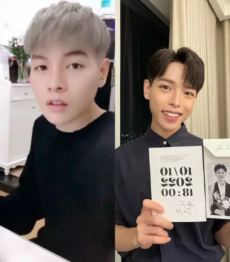 Duc Phuc bi che phau thuat tham my thanh Erik-Hinh-4