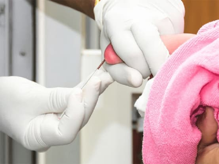 Tai sao ban can kiem tra mau got chan khi tre vua moi sinh ra?-Hinh-2