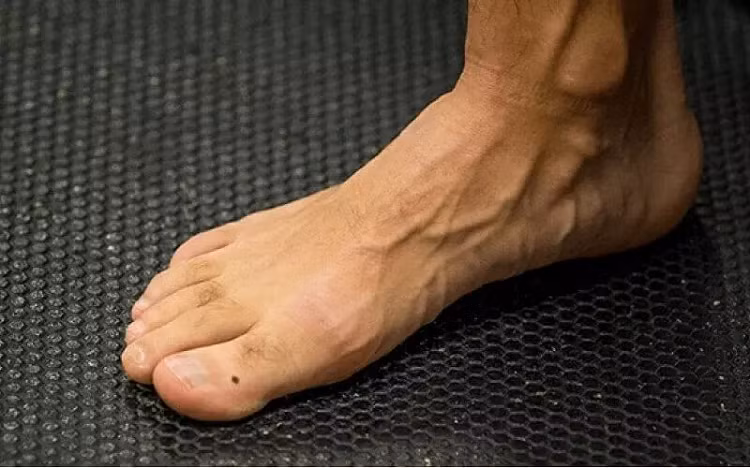 4 not ruoi o ban chan bao hieu tai loc vo bien, hau van no du-Hinh-2