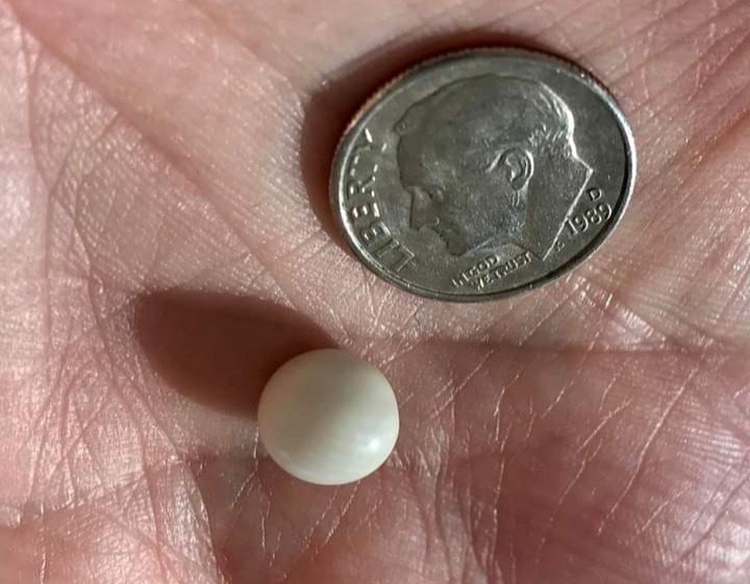 An mon khai vi bat ngo phat hien vien ngoc trai dat gia-Hinh-3