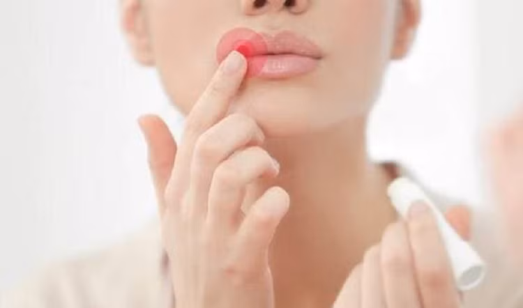 Khoai mo la 'bau vat' khi an dung, va 'rac roi' khi an khong dung-Hinh-7