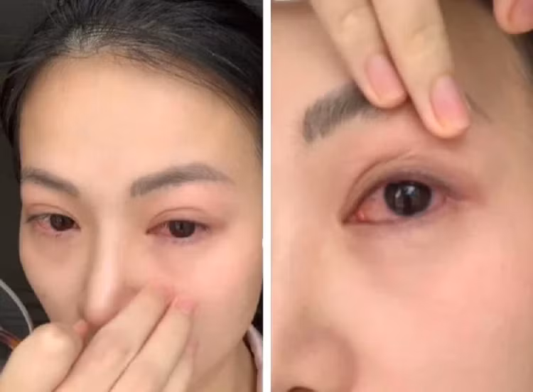 Hoa hau Phuong Khanh gap van de nghiem trong o mat