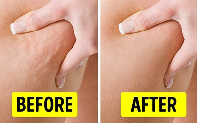 Giảm triệu chứng sần vỏ cam: Để giảm bớt tình trạng này, sử dụng cà phê xay mát-xa lên da. Cách này giúp tăng cường lưu thông máu và giúp da săn chắc, giảm triệu chứng sần vỏ cam trên da.