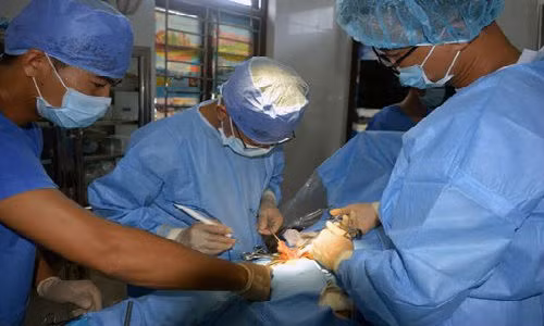 Benh xa dao Song Tu Tay mo cap cuu viem ruot thua cap