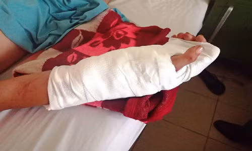 Benh vien DK Khanh Hoa noi thanh cong ban tay dut lia