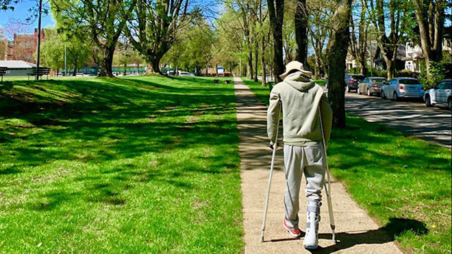 Anh Võ Duy Nghiêm (Việt kiều bị cắt gân chân, tạt axit) lần đầu ra ngoài đi dạo sau gần nửa năm điều trị. Ảnh FBNV