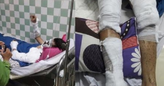 Ngày 6/5, CA tỉnh Quảng Ngãi phát đi thông báo nhận dạng 2 nghi phạm: đều là nam giới cao khoảng 1,6 m, nói giọng bắc, tuổi từ 20 đến 30 tuổi. đội mũ lưỡi trai, mặc áo khoác dài tay, quần jeans, dùng xe Wave xanh, cầm bình thủy tinh đựng axit Sunfuric và một dao bầu dài khoảng 30 cm.