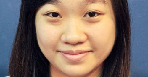 Bat ngo ly giai vi sao mui ta tet, mui tay cao