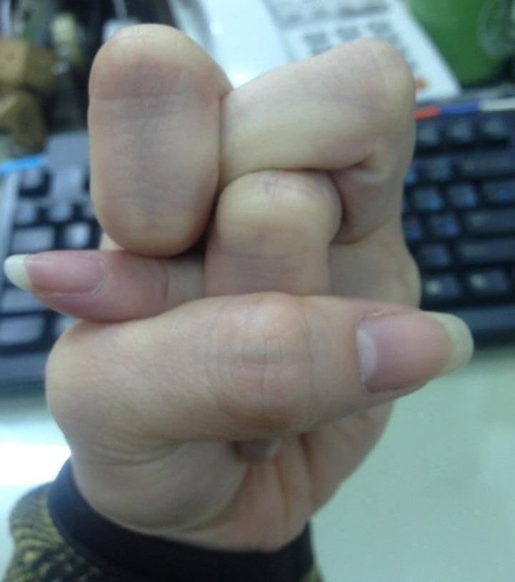 Đây được gọi là Yoga cho ngón tay, đa số mọi người đều không thể làm được.