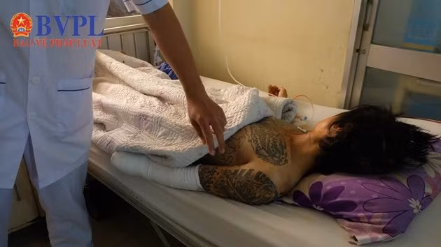 Nam thanh nien bat ngo bi 2 doi tuong la mat chem dut lia tay