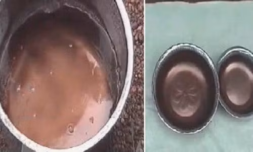 Trong khoảng thời gian từ ngày 25/7 đến 23/9/2001, hiện tượng “mưa máu” xuất hiện ở bang Kerala, miền nam Ấn Độ. Nước mưa trút xuống khi đó có màu đỏ như máu. Nhiều giả thuyết đã được đưa ra để lý giải hiện tượng bí ẩn này. Theo Tiến sĩ Godfrey Louis, một loại tế bào sinh học trong nước mưa không chứa ADN và có thể nó là các dạng sống ngoài hành tinh. Ảnh: Oddee.