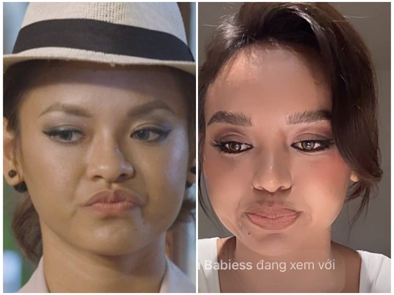 Chiếc mũi trước và sau khi dao kéo của Mai Ngô. Ảnh: Dân Việt.