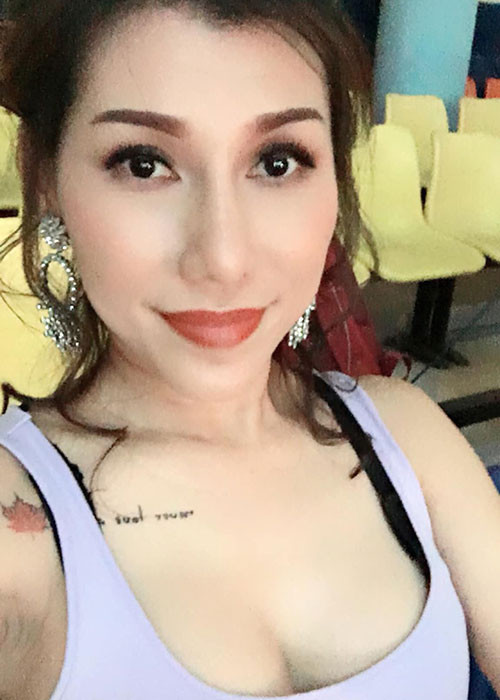 Nữ ca sĩ không sợ đặt túi ngực mới sau sự cố.