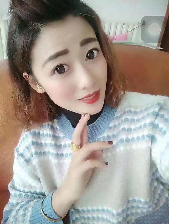 Cau be 7 tuoi bi me ke do nuoc soi len nguoi trung phat-Hinh-2