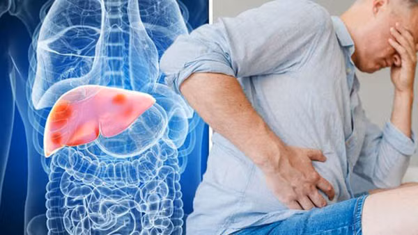 Để nhận biết dấu hiệu gan có vấn đề, chuyên gia khuyên chú ý đến những thay đổi trên cơ thể, đặc biệt không nên bỏ qua dấu hiệu ba vị trí cơ thể “bốc mùi” dưới đây.