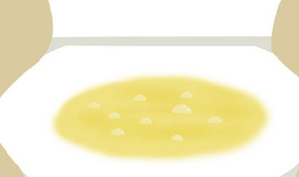 Nước tiểu có mùi hôi. Nước tiểu chứa nhiều amoniac, có mùi khai. Bình thường, mùi nước tiểu không rõ ràng, chỉ dễ nhận diện khi bạn uống ít nước hoặc nhịn tiểu lâu.