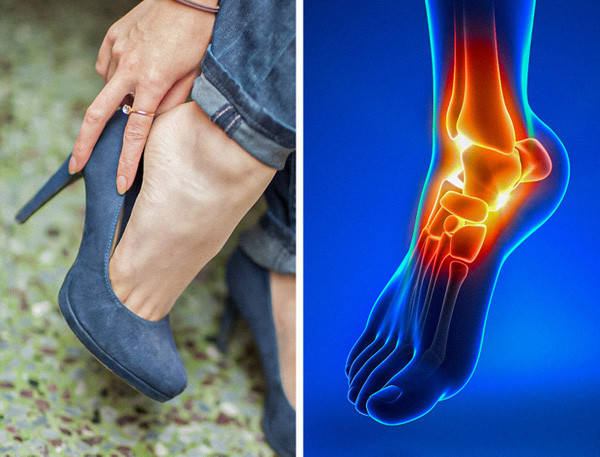 Đi giày cao gót. Giày cao gót giúp vẻ ngoài của bạn cuốn hút hơn. Tuy vậy, gắn bó với chúng thời gian dài hại nhiều hơn lợi. Nghiên cứu cho thấy, phụ nữ đi giày cao gót hàng ngày khiến tình trạng sức khỏe chân bị đe dọa.