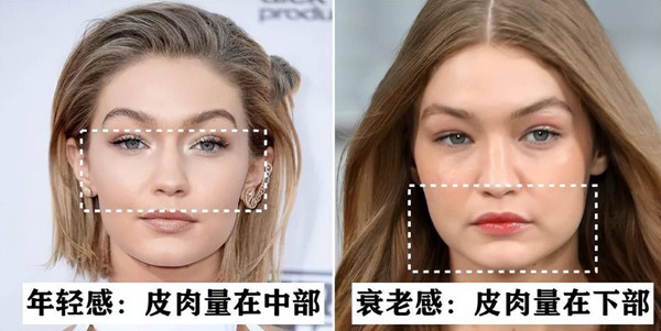 Thật vậy, xương gò má mở rộng khiến gương mặt như bị chùng xuống, các đường nét chảy xệ mang tới cảm giác mệt mỏi, thiếu sức sống dù nội hàm bạn lạc quan, vững mạnh.