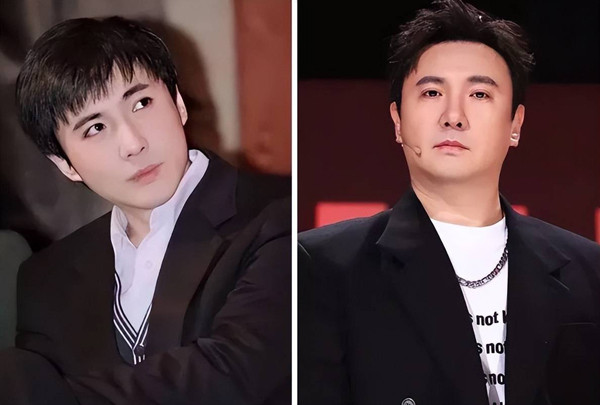 Xương gò má mở rộng còn bắt nguồn từ cơ địa, sự phát triển của khuôn mặt. Bất kể lý do là gì, sự mở rộng xương gò má khiến nhan sắc bị ảnh hưởng lớn, gương mặt không có được sự thanh tú.