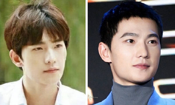 Cùng với tuổi tác, xương gò má sẽ mở rộng hơn. Điều này bắt nguồn từ quá trình lão hóa, cơ mặt bị chùng xuống khiến phần dưới gương mặt trở nên to hơn.