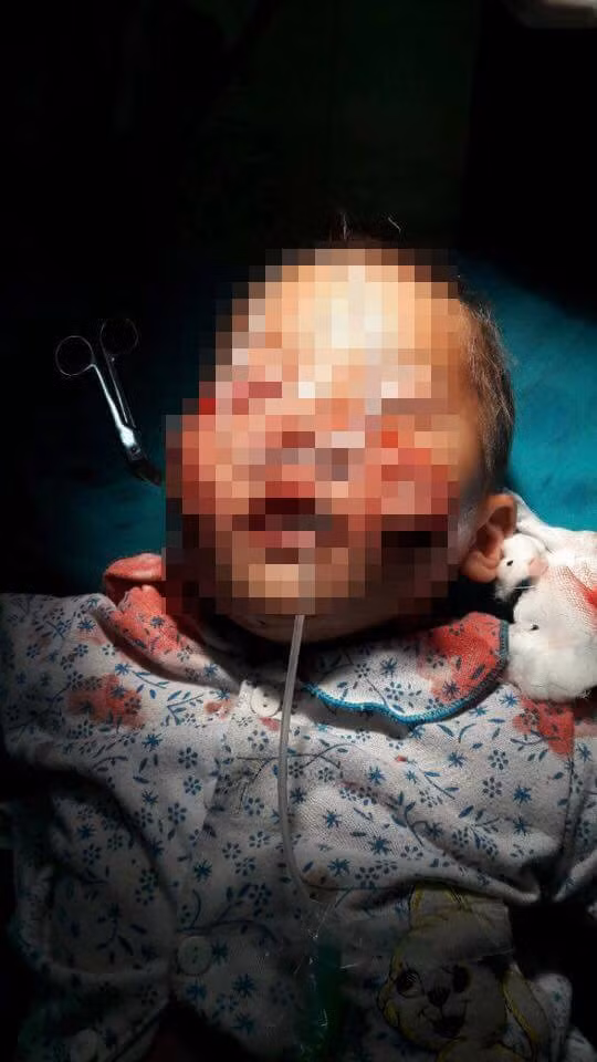 Cháu Trường vẫn đang được các bác sĩ điều trị tích cực.