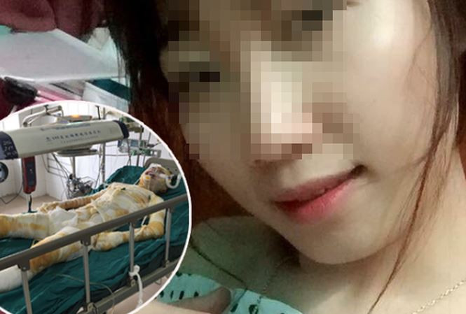 Nạn nhân H. Ảnh: ANTĐ.