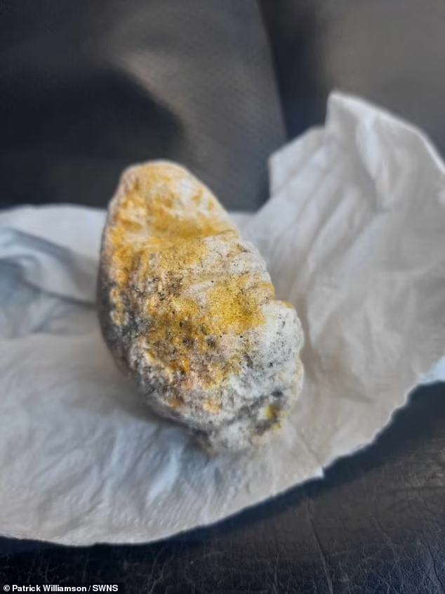 Long diên hương là một sản phẩm chất thải của cá voi và được gọi là "vàng nổi" bởi giá trị của nó.