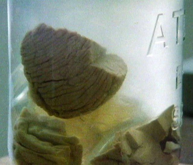 Bộ não của Einstein, sau khi được tách ra khỏi cơ thể ông, đã trở thành một "mẫu vật" khoa học.