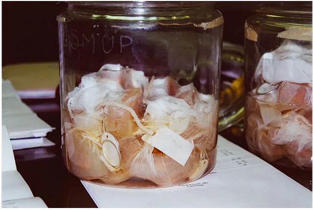 Harvey cắt bộ não của thiên tài Einstein thành 240 mảnh và giữ bí mật trong 43 năm.